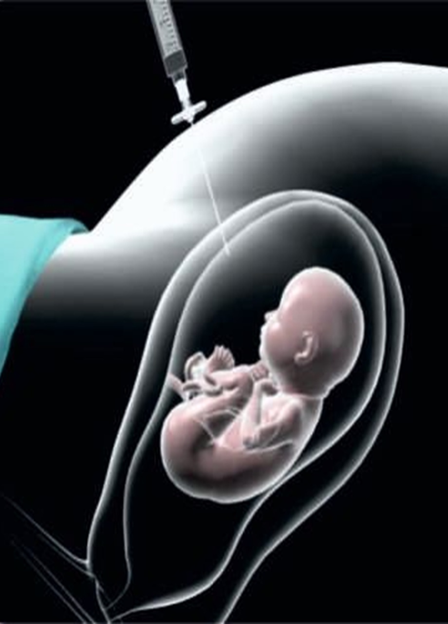 Fetal-intervention1 - Copy